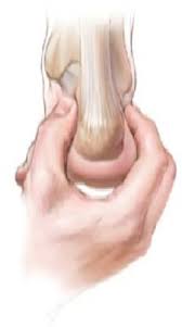 Image result for Calcaneal Apophysitis