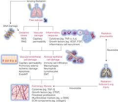 Radiation Induced Lung Injury Chest