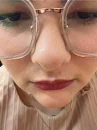 What's causing my nose skin issue?