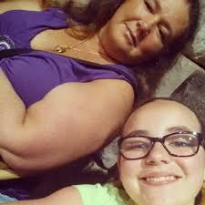 Dollywood scooter rentals for knee injuries