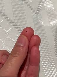 Image result for bed bugs droppings