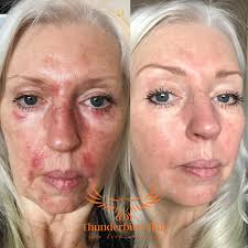 Wild Crafted Repair Balm