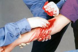 Por fuera del cuerpo, cuando la sangre sale a través de una ruptura en la piel.