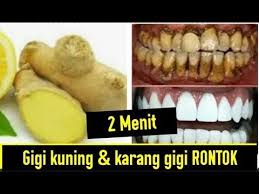 2 Menit Menghilangkan Kerang Gigi Dan Memutihkan Gigi Youtube Pemutih Gigi Alami Obat Alami Pemutih Gigi