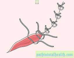 غرز على المنشعب بعد الولادة صحة المرأة 2021