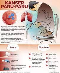 Mendengar kata kanker mungkin akan membuat anda merasa takut. Kenali Kanser Paru Paru