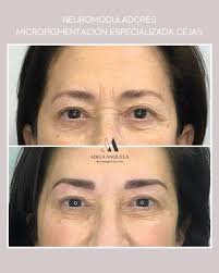 ✨ ¡Tenemos una gran noticia! Desde YA, contamos en nuestro centro con la  colaboración de @ojeras.albasimon , especialista en Micropigmentación y  Dermopigmentación Correctiva. Alba llega para ayudarte a mejorar: ✔️ Ojeras  oscuras (