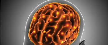 Best Treatments for Brain Stroke: Stroke Treatment in Delhi