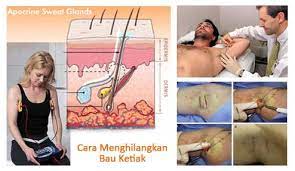 Jeruk purut juga digunakan sebagai cara menghilangkan bau ketiak secara alami dan cepat. Cara Menghilangkan Bau Ketiak Secara Kesehatan Bersama Facebook