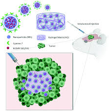 Barbani, niccoletta rosellini, elisabetta donati, marco costantino, paolo cristallini, caterina and ciardelli, gianluca 2017. Intratumoral Injection Of Hydrogel Embedded Nanoparticles Enhances Retention In Glioblastoma Nanoscale Rsc Publishing