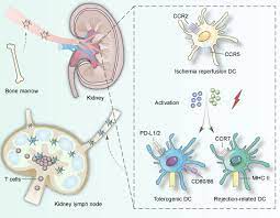 Frontiers Dendritic Cells Versatile Players In Renal Transplantation Immunology