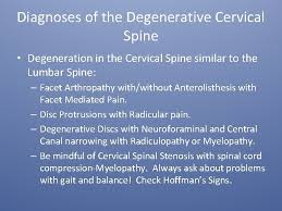 Facet Arthrosis Cervical Spine Icd 10