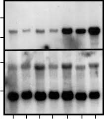 Basic calcium phosphate (BCP) crystal induced accumulation of matrix...