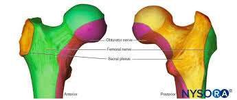 Image result for Intrapleural Anesthesia