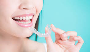 5 Benefits of Invisalign Clear Aligners for Straightening Your Smile -  Dentus Family Dental