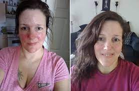 Exercises not only keep you slim and healthy, but also help produce new skin cells, contributing a lot in the process of evening your skin. 23 Products Designed To Help You Get A More Even Skin Tone