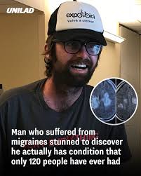 Everyone else I believe, who has this fungus, is dead unfortunately.' 😨