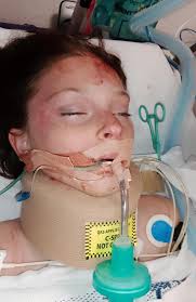 Ruby-Storm Sarahmay Kayrooz, 12, fighting for life after e-scooter crash,  Sunshine Coast