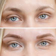 Cosmetic eyebrow tattooing frame your face and add definition beautifully. Photo Comparison Before And After Permanent Makeup Tattooing Of Eyebrows For Woman In Beauty Salon Stock Photo Picture And Royalty Free Image Image 115768369