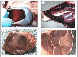 Image result for Myopathy