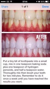 Whiten Teeth At Home Health And Beauty Beauty Hacks Health