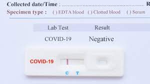 Tells you if you have an active coronavirus infection and if you are contagious. Ini Golongan Yang Bisa Rapid Test Massal Virus Corona