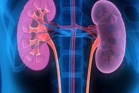 Ginjal adalah organ dalam tubuh yang berfungsi untuk menyaring zat racun dalam darah. Waspadai Serangan Penyakit Ginjal Kronik