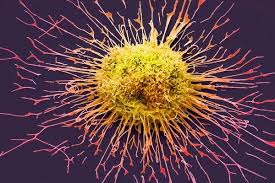 Cancer refers to any one of a large number of diseases characterized by the development of abnormal cells that divide uncontrollably and have the ability to infiltrate and destroy normal body tissue. How Scientists Shot Down Cancer S Death Star The New York Times