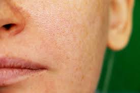 How To Get Rid Of Pores: Tips & Products To Shrink Your Pores | Glamour Uk