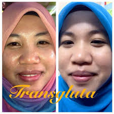 Cocktail whitening di percaya dapat memutihkan kulit 2x lebih cepat di banding produk lain , karena obat tersebut merupakan obat yang paling lengkap komposisinya dan paling recomended. Transgluta By Zenia Rahsia Memutihkan Kulit Satu Badan Ayue Idris