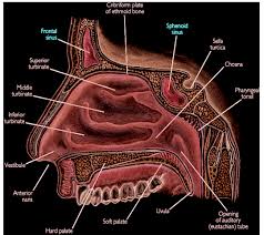 Image result for Sinusitis Prediction Rule