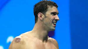 Although this article first appeared in 2016 with the costa rica cup of excellence but cupping process is still the same today as it was back then. Cupping The Ancient Practice Used By Michael Phelps