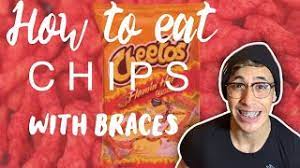 How To Eat Chips With Braces! - Youtube