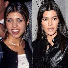 Kourtney kardashian plastic surgery were extremely successful. 2 Which Actresses Ruined Their Face With Plastic Surgery Quora In 2021 Kourtney Kardashian Plastic Surgery Kardashian Plastic Surgery Plastic Surgery