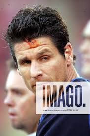 Torwart Mike Pollitt mit einer genähten Platzwunde auf der Stirn