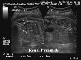 Fetal Kidneys