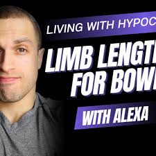 Limb Lengthening Podcast