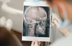 Image result for Skull XRay