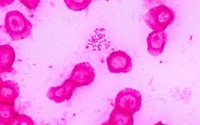 Image result for Striga baumannii