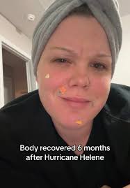 Singer Island Hurricane Helene