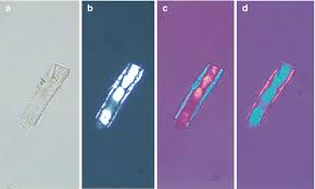 Image result for Polarized Microscopy