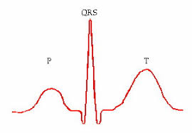 Jun 12, 2021 · 病毒感染、疫苗接種本來就會造成比什麼都不做的背景值還要高的心肌炎 這也不是新聞了 重點是機率低到哭 實際上死的人也沒多少 (假設你說診斷困難，那我不看診斷，我把所有接種疫苗後死的都算在心肌炎頭上，也是十萬分之~百萬分之而已) ※ 編輯: å¿ƒè‚Œç‚Ž å¿ƒè‡Ÿå…§ç§' ä¸‰è»ç¸½é†«é™¢ Tri Service General Hospital
