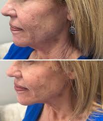 Julie Jackson McDonald (@the_wellnesswitch_cnm) • Instagram photos and  videos