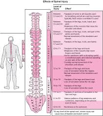 Spinal Cord Injury In Children Injuries And Poisoning Msd Manual Consumer Version