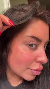How To Lighten Hair Dyed Too Dark: 10 Easy Ways To Do It