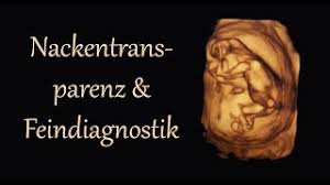 Meinem fa sei der beste zeitpunkt für die feindiagnostik (grosser organultraschall) bei 23+ ! 14 Ssw Fruhe Feindiagnostik Nackentransparenzmessung Und Was Genau Gemessen Wird Youtube
