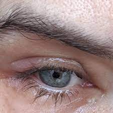 Anthony Panariello Md Palisade Eye Ophthalmologists 203 Palisade Ave Jersey City Nj Phone Number