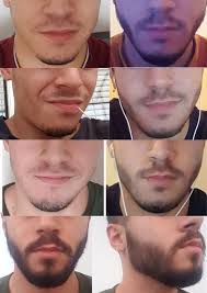 Facial hair is hair grown on the face, usually on the chin, cheeks, and upper lip region. How Can One Grow A Thick Beard At A Faster Rate Quora