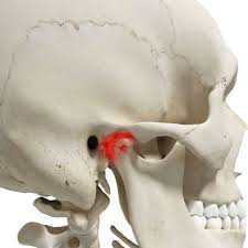 Trastorno Temporomandibular Signos Y Sintomas Clinica Dental Tiiz