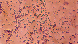 Impfung Polio Hepatitis B Haemophilus Influenzae Typ B Br Wissen
